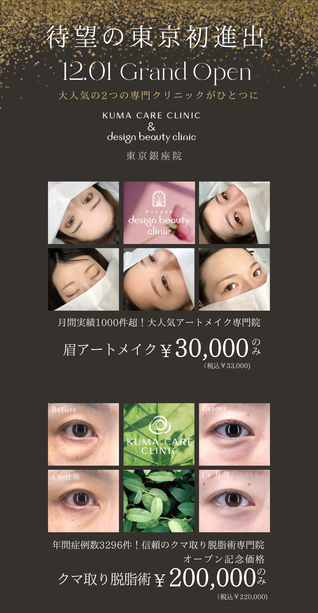 ついに東京進出！【2025年12月1日】アートメイク東京銀座院オープン！